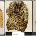 normal human lung compared to diseased lung